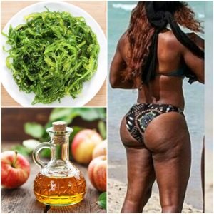 Cellulite Home Remedies For Women