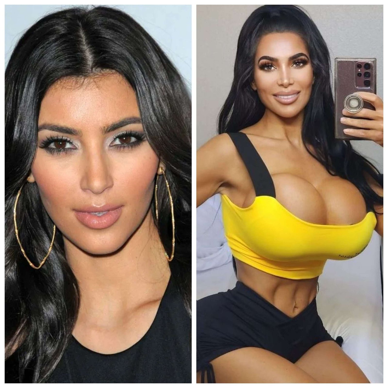 Kim Kardashian Lookalike Dies After Plastic Surgery