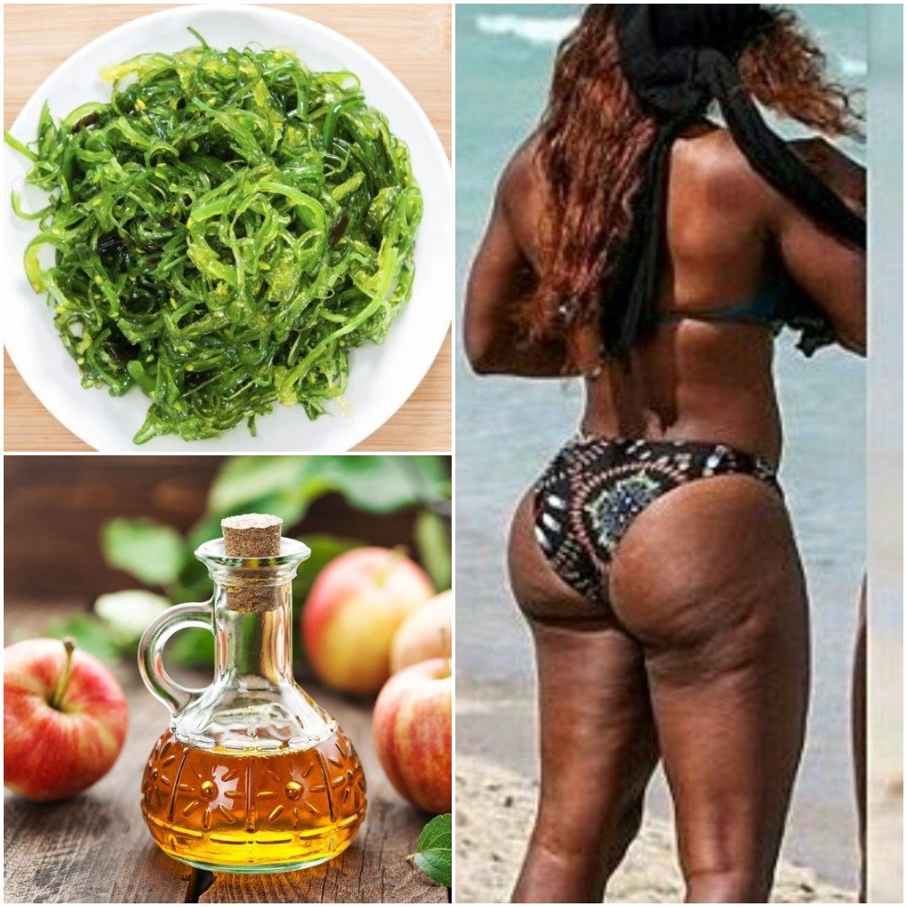 Cellulite Home Remedies For Women