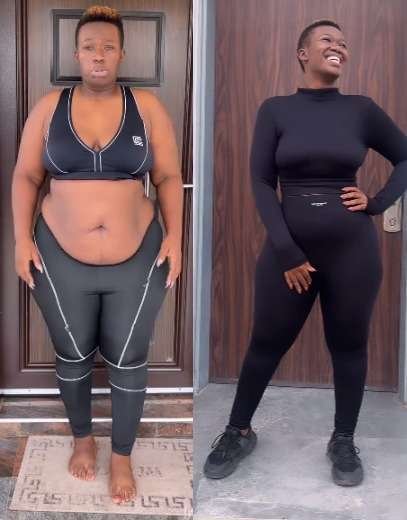 Real Warri Pikin Weight Loss Surgery Update